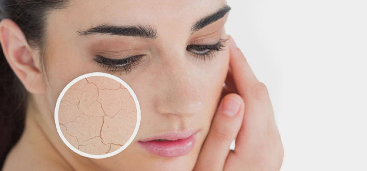 Dry skin